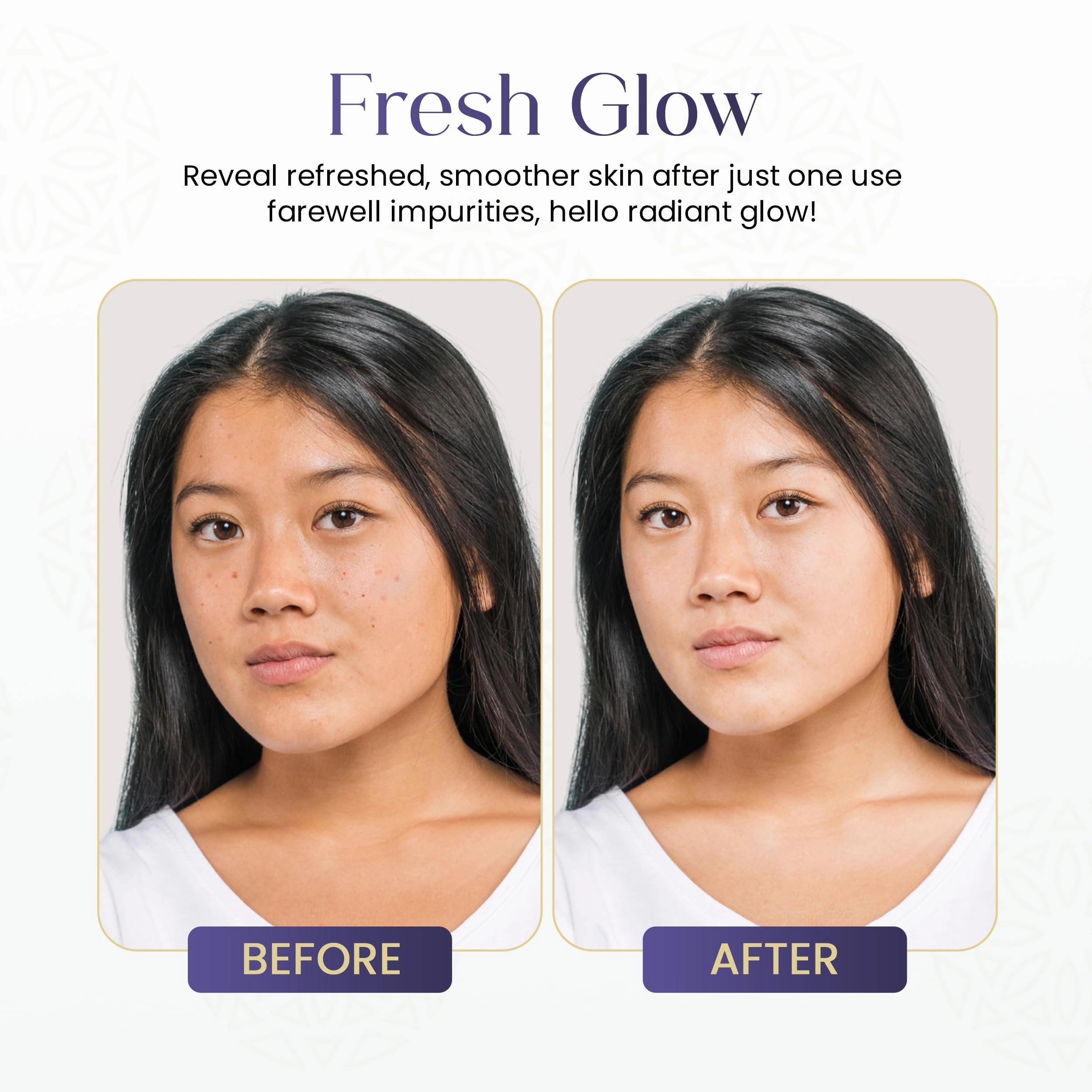 Glycolic Acid Toner Ordinary Glycolic Solution for Face Hydrating and Skin Toner for Women Face with AHA, Aloe Vera, Extract Facial Toner for Brightening, Acne, Exfoliation, and Skin Care 6.4 oz
