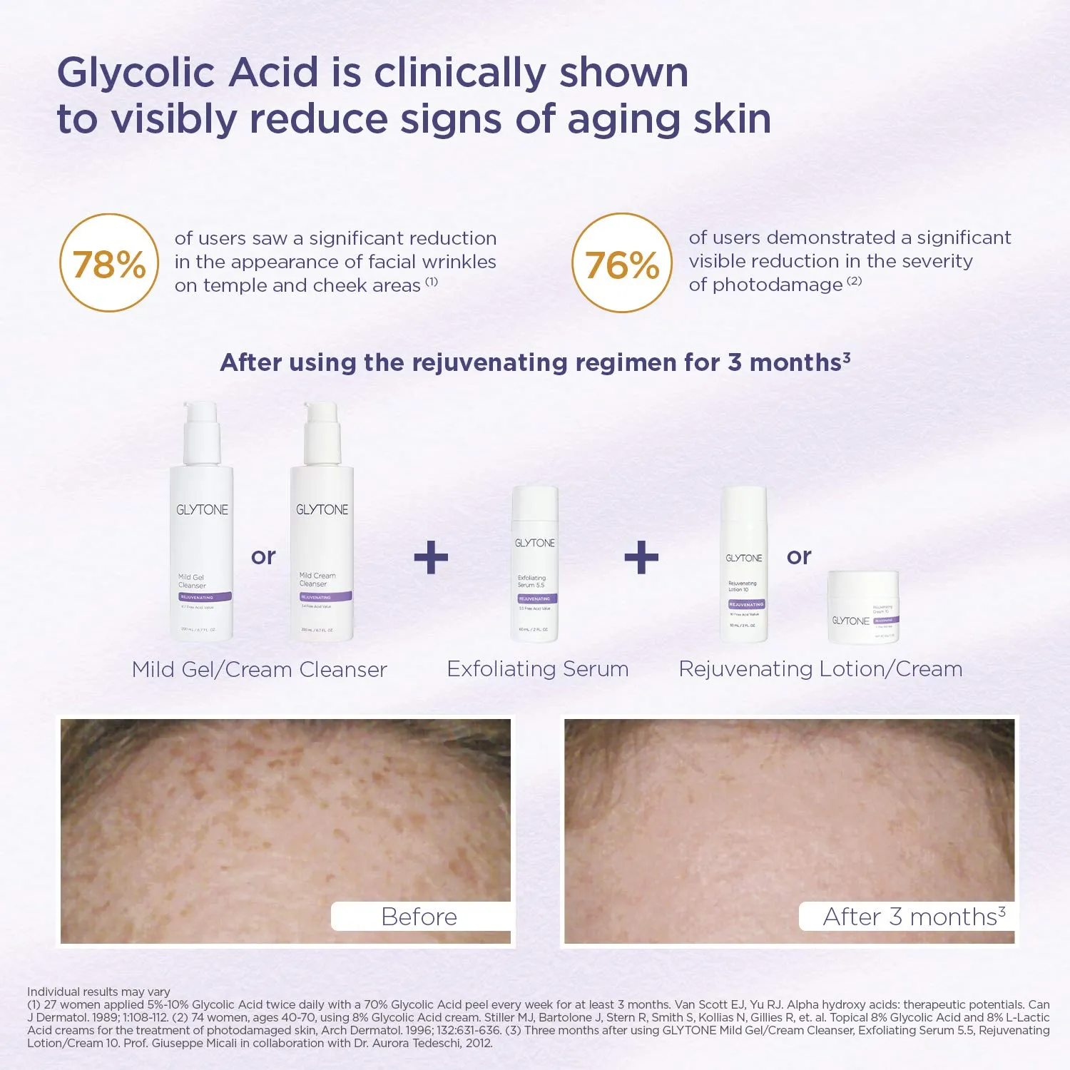 Glytone Mild Cream Cleanser | Exfoliate & Moisturize with 3.4 Free Acid Value Glycolic Acid & Glycerin | Face Wash for Women Removes Makeup & Oil | Face Cleanser for Dry Skin | 2 Fl oz.