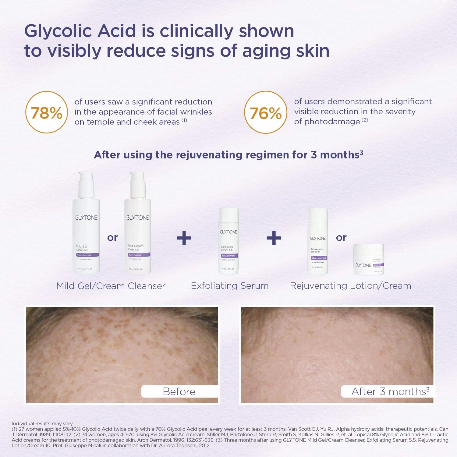 Glytone Mild Cream Cleanser | Exfoliate & Moisturize with 3.4 Free Acid Value Glycolic Acid & Glycerin | Face Wash for Women Removes Makeup & Oil | Face Cleanser for Dry Skin | 13.5 Fl oz.