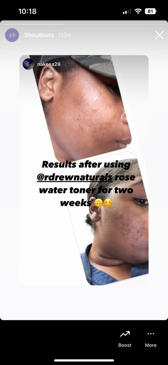 Rosewater & Aloe with Calendula Facial Toner