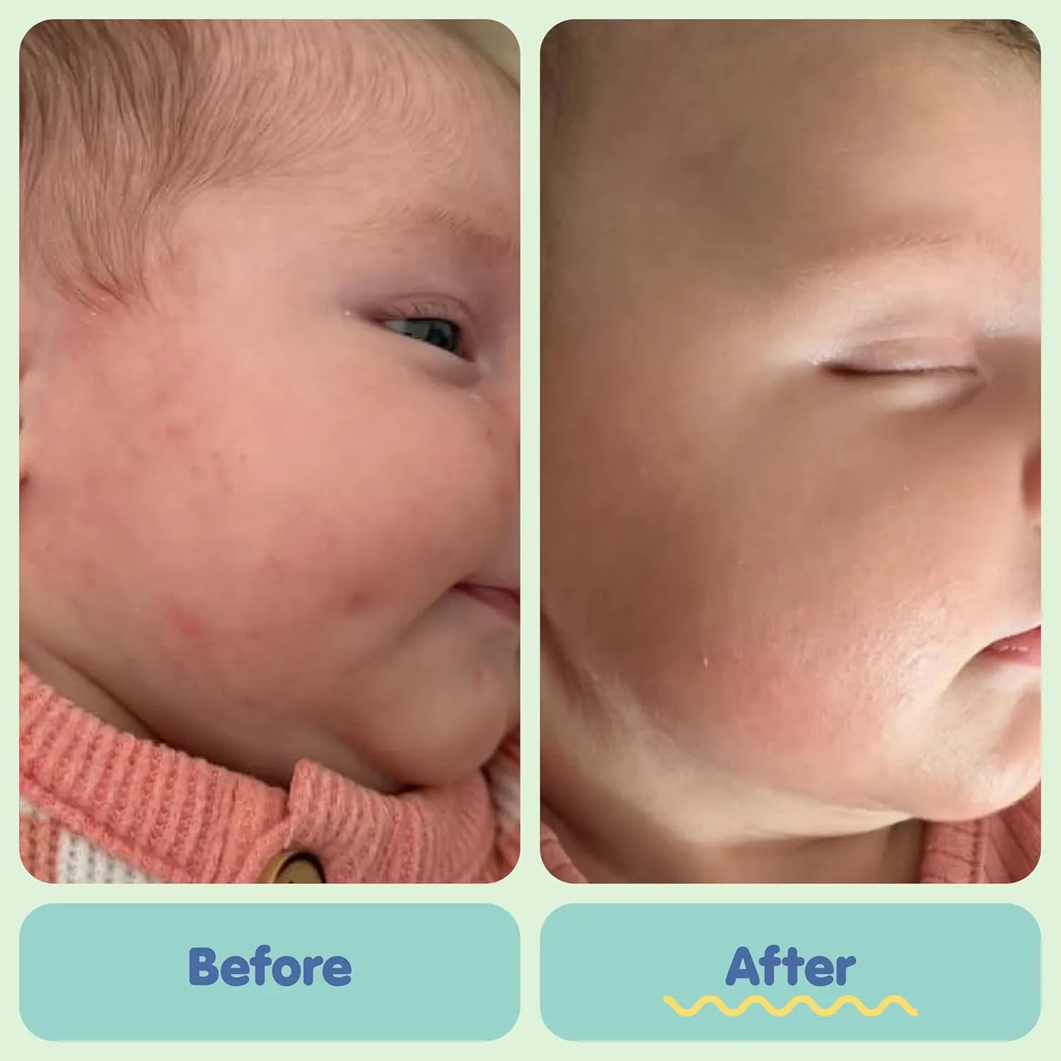 TUBBY TODD All Over Ointment - Baby Eczema Cream - Everyday Multi-Purpose Baby Skin Relief Cream - Sensitive Skin, Dry Skin & Irritation - Steroid & Gluten Free - Fragrance Free, 2 Pack 3.5oz & 8oz